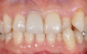 拡大　エンプレスククラウン