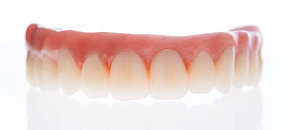 オールオンフォー仮歯