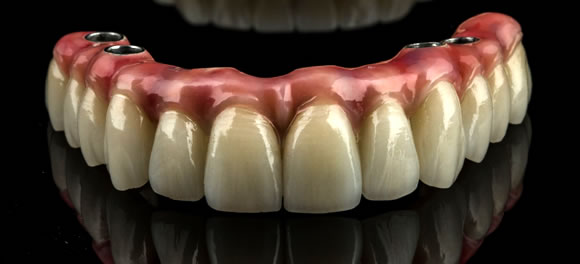 オールオンフォー最終ブリッジ