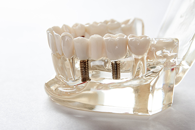 メインテナンス